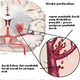 Illustration for article titled Obat Strokeem/em